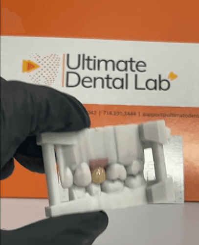 Ultimate Dental, Denture, Crown & Implants Lab cover photo