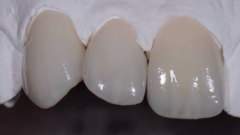 JTL Dental Lab, Inc. cover photo