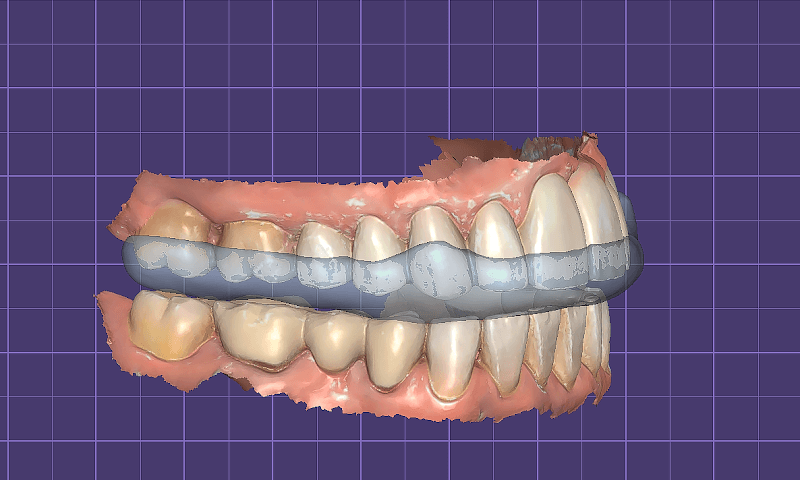 Bright Bites Dental Lab cover photo